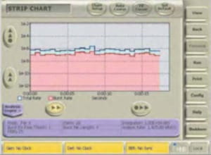 BERTScope-BitAlyzer-Datasheet--413723-15-N.jpg BERTScope-BitAlyzer-Datasheet--413723-15-N